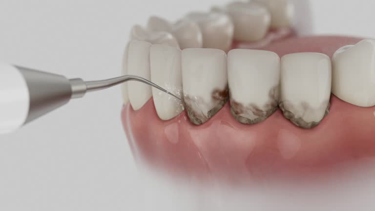 Reliable Dental contractor in Jerome, IL by Smile Center Dentistry